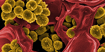 Cancer and Ageing Research
